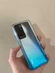 Redmi Note 11  6+2/128