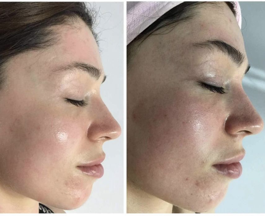 Нужны Модели для процедур