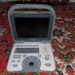 УЗД апарат model SSI 600