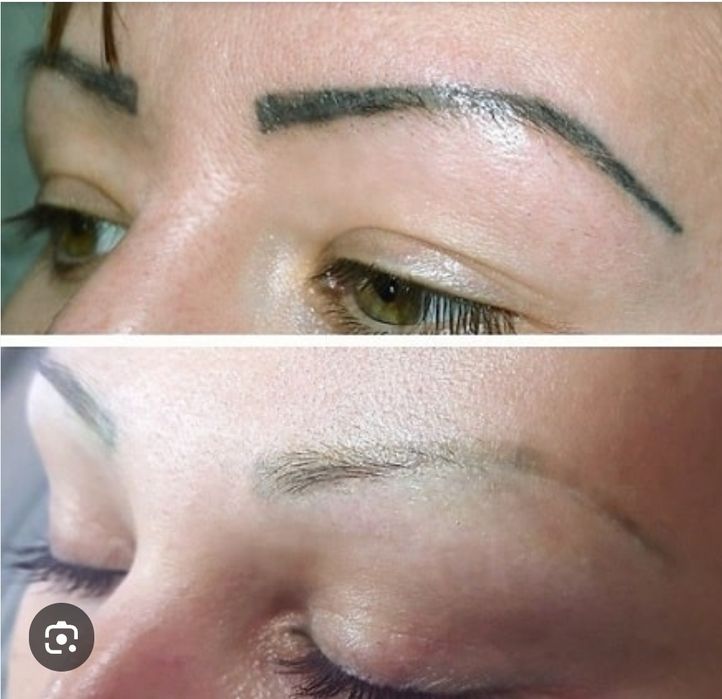 Удаление татуажа бровей.Татуаж учириш.