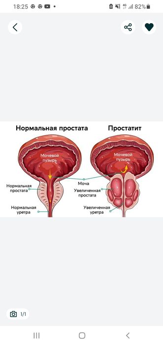 Парень массажист Урологический массаж