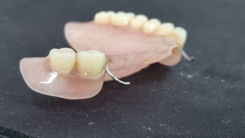 Починка протезов