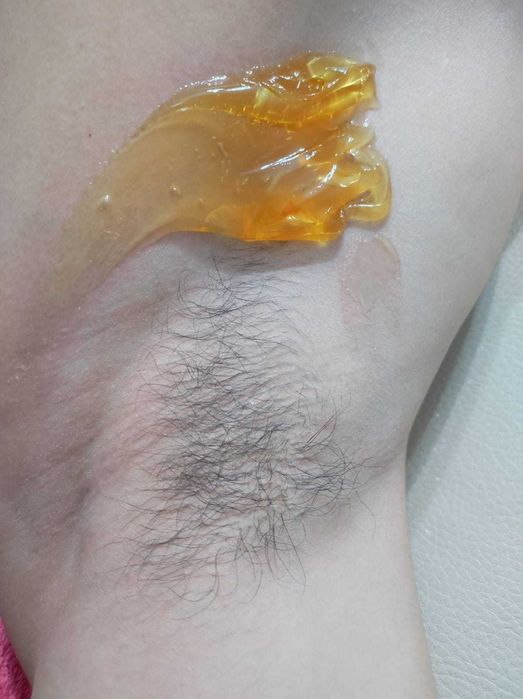 Шугаринг/Талдыкорган