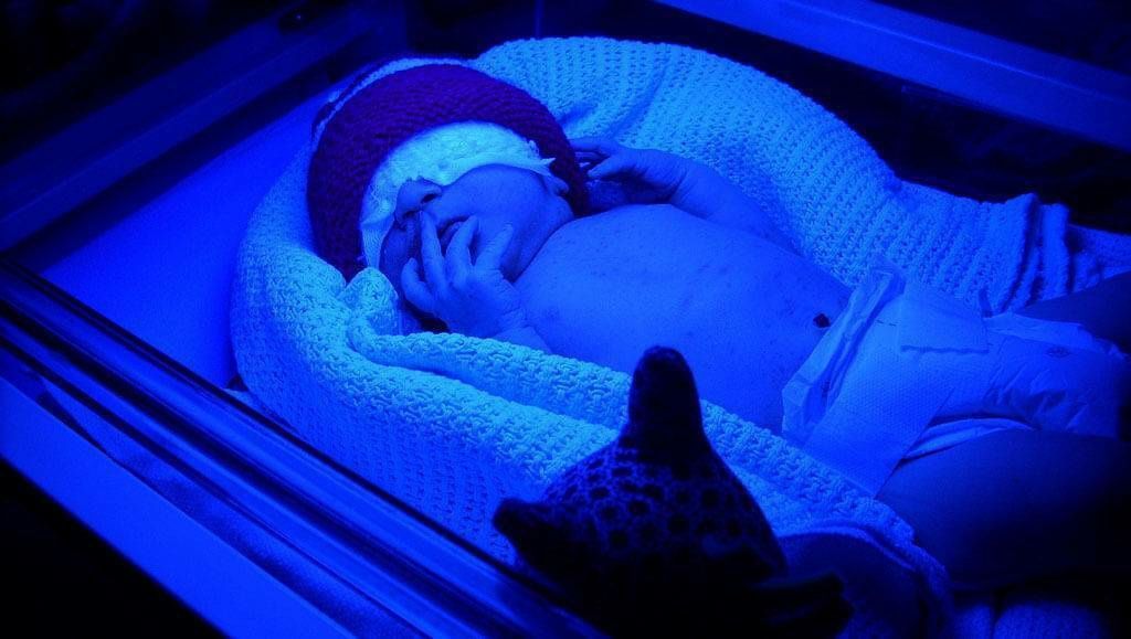 Аренда фотолампы от желтушки для новорождённых детей.  Билитест