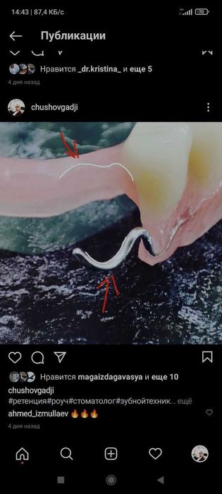 изготовление зубных протезов