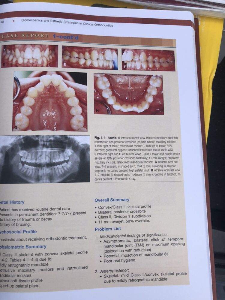 Biomechanics and Esthetics Strategies in Clinical Orthodontics NANDA