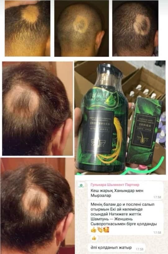 Женьшень шампунь шаш шығарады оригинал