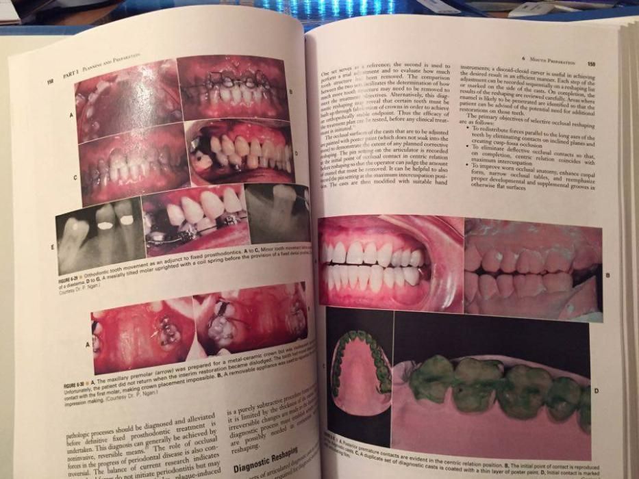 Contemporary Fixed Prosthodontics 5nd Edition 2015 Rosenstiel