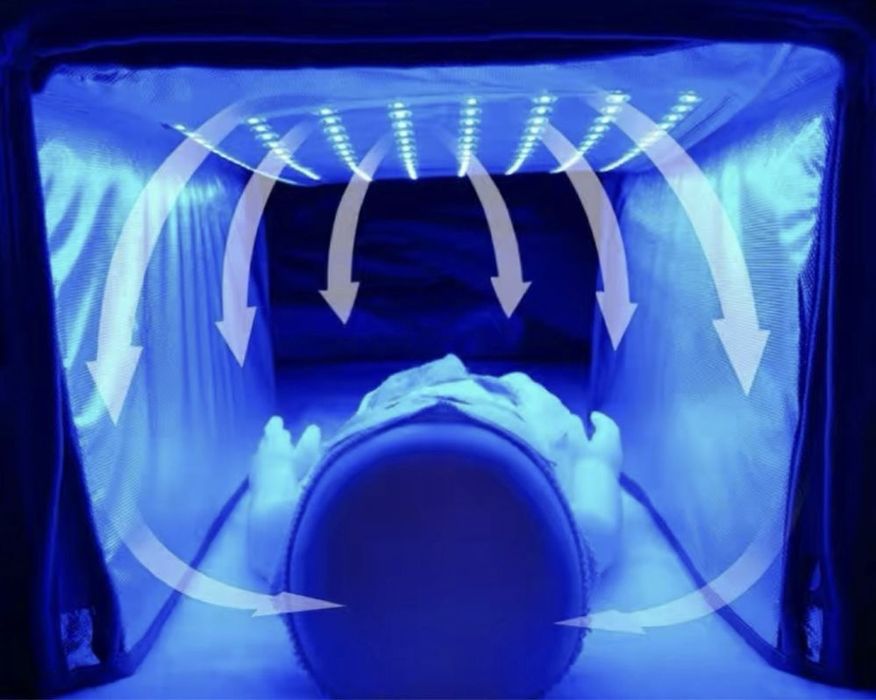 Продам фотолампа от желтухи