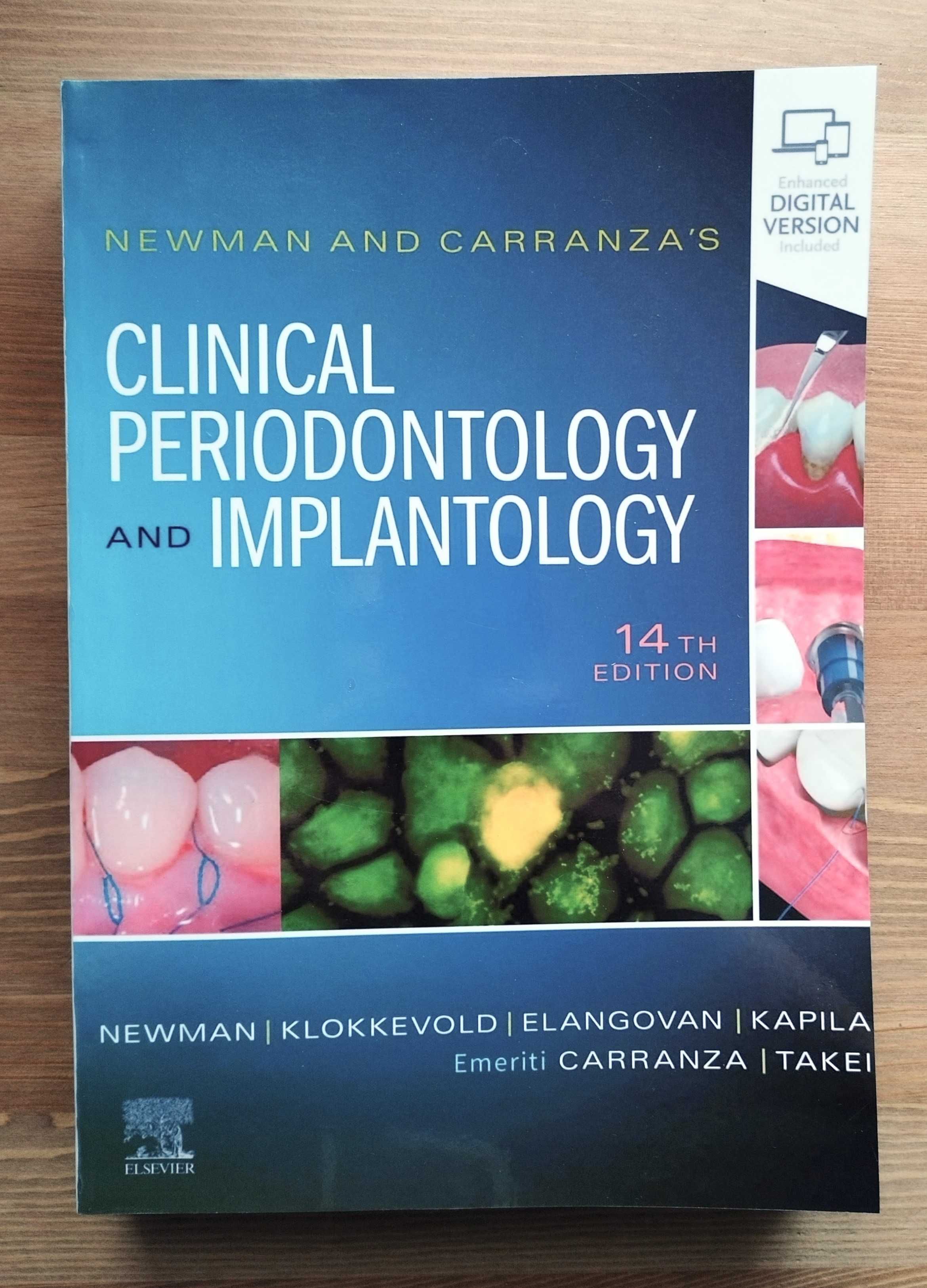 Newman and Carranza's Clinical Periodontology and Implantology Ed. 14
