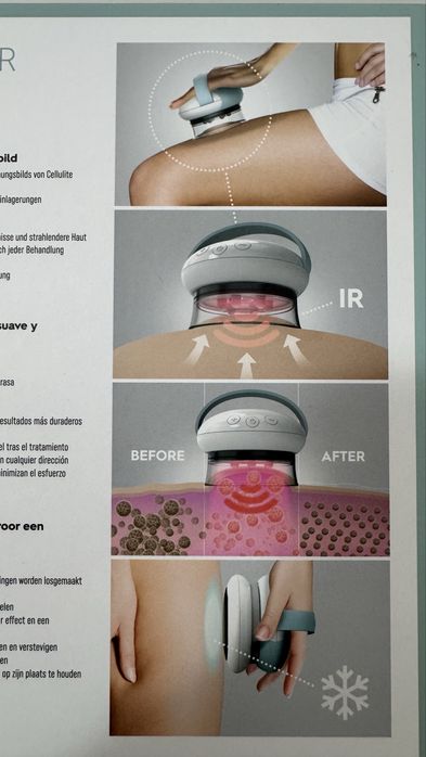 NOU Aparat anticelulitic HoMedics - vacuum + infrarosu + răcire