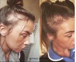 Șampon ageLOC Nutriol Scalp & Hair