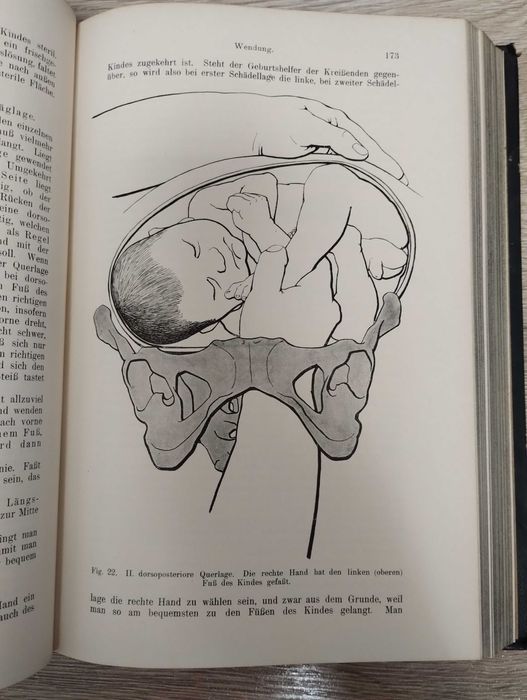 Carte medicina foarte veche 1912, in limba germana