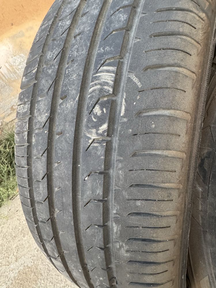Onix radnoy baloni