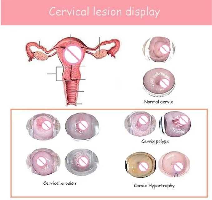 360° Гинекологично Неинвазивна Лазерна Терапия за Влагалищно Затягане