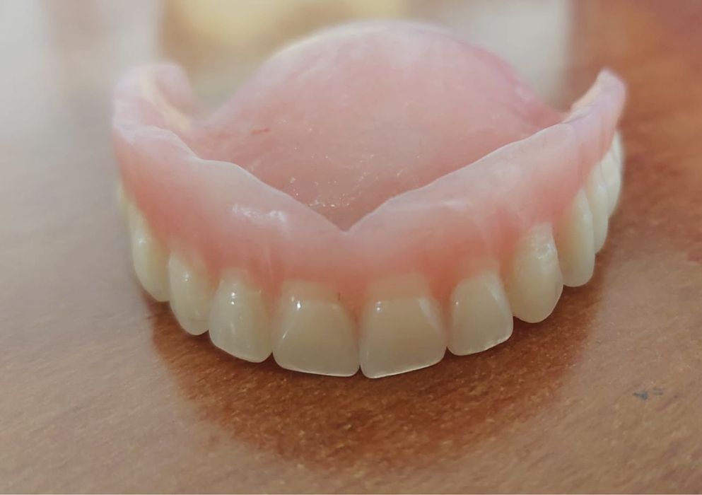 Proteze dentare acrilice totale si partiale