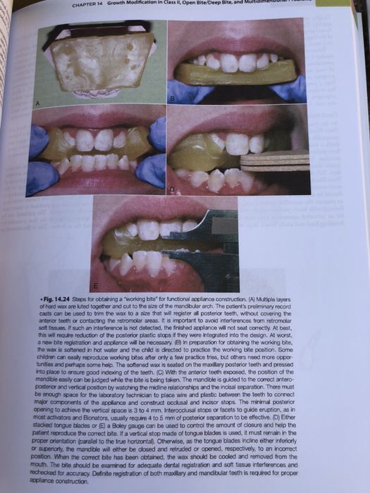 Contemporary Orthodontics,William R. Proffit,6th edition 2019