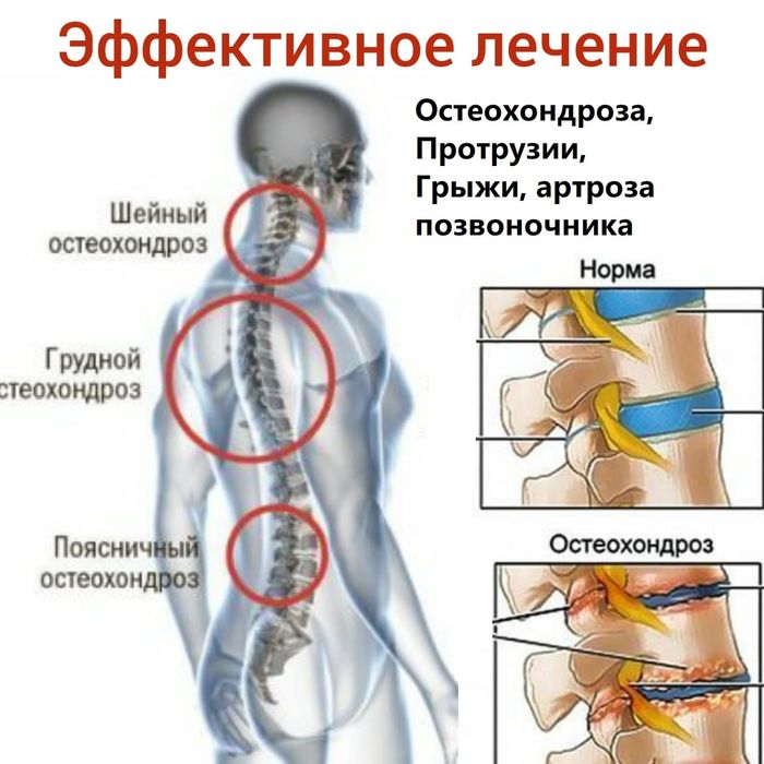 Иглотерапия, массаж, китайская, восточная медицина