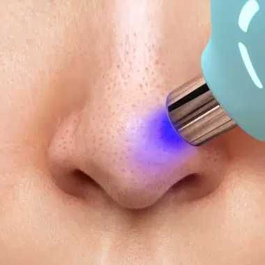 Dispozitiv de indepartare a punctelor negre cu lumina LED, FOREO KIWI™