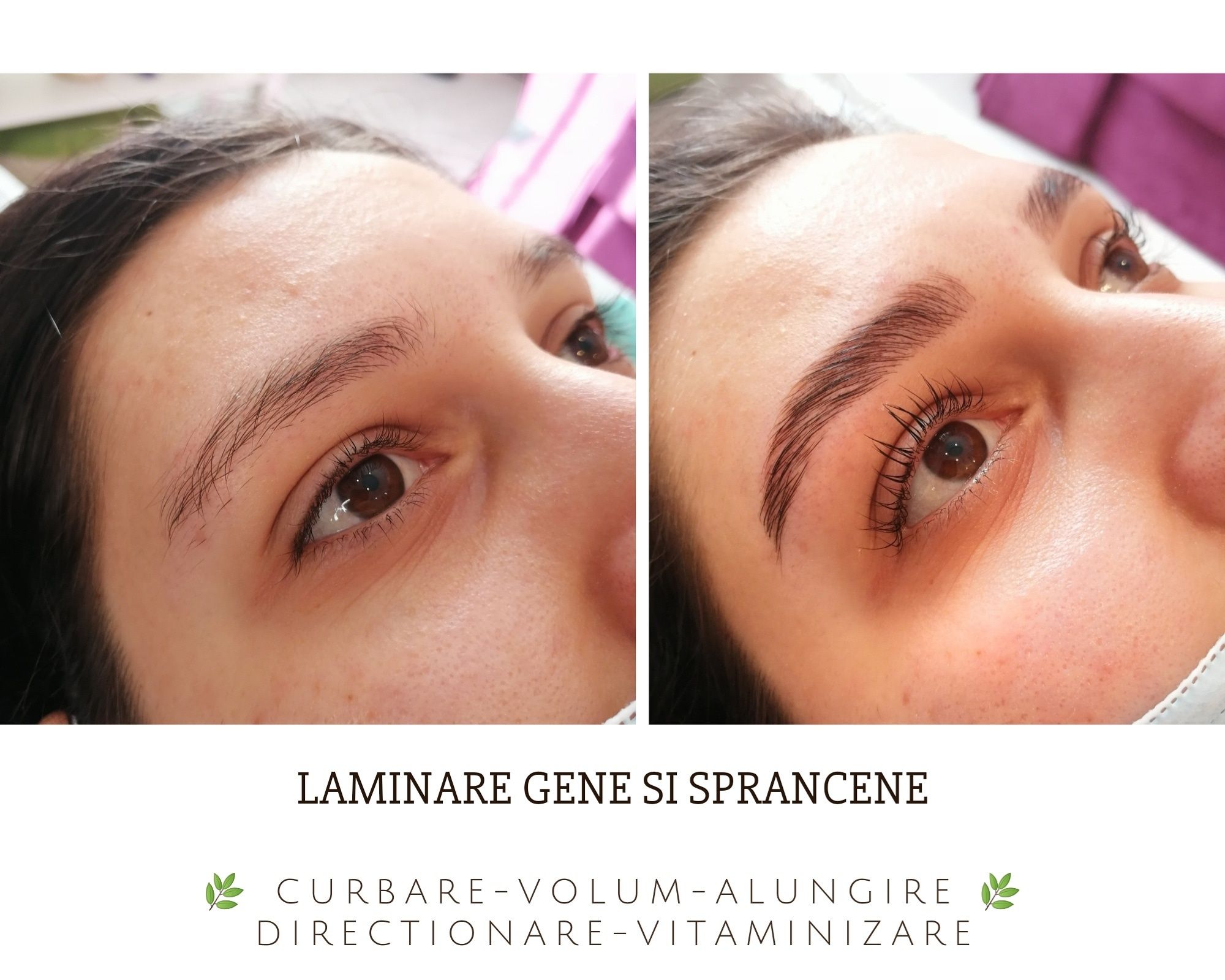 LAMINARE gene/sprancene & PENSAT