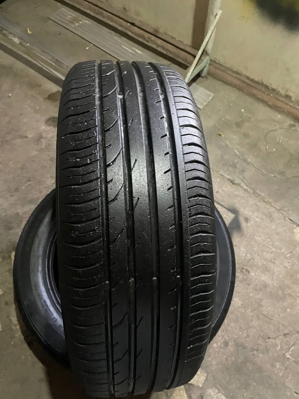 Balon       contenital.    215   55.      18       holati        yahsh