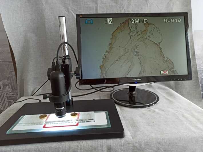 Trichineloscop digital