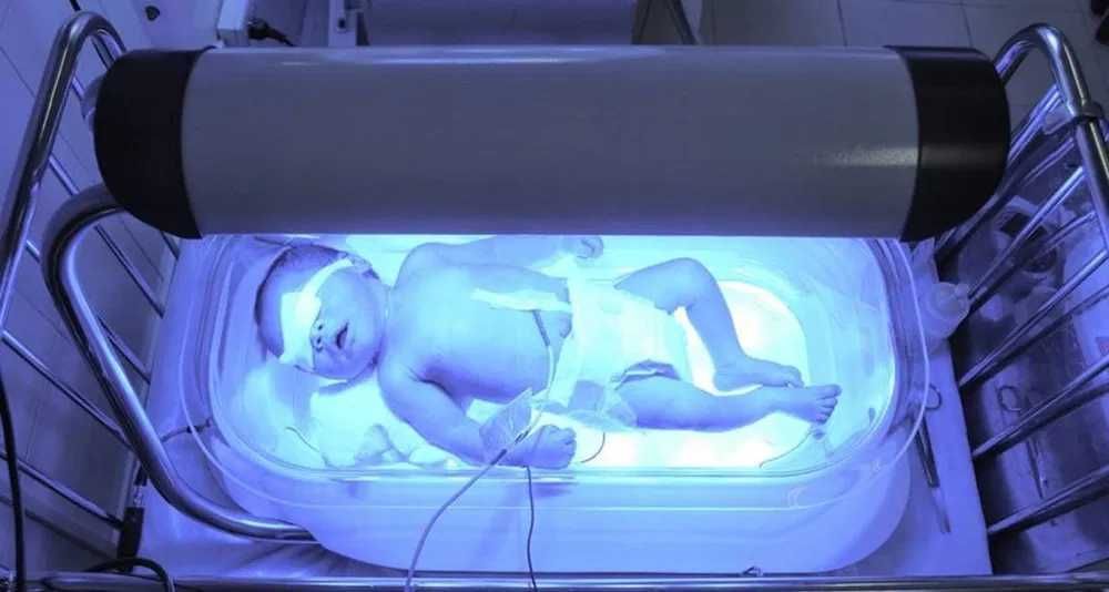 Fotolampa / Fototerpiya / Bilirubin miqdorini aniqlash 50.000