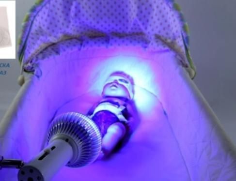 Фотолампа от желтухи