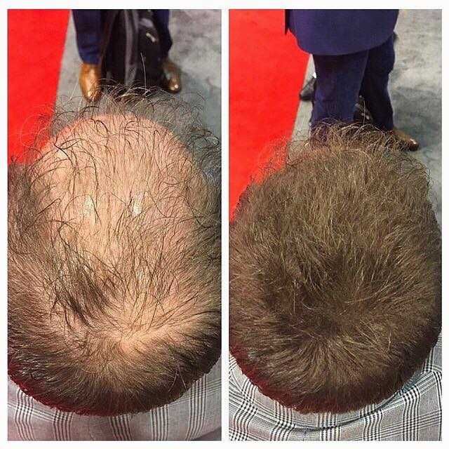 QAZAMI 5 гр. влакна за коса