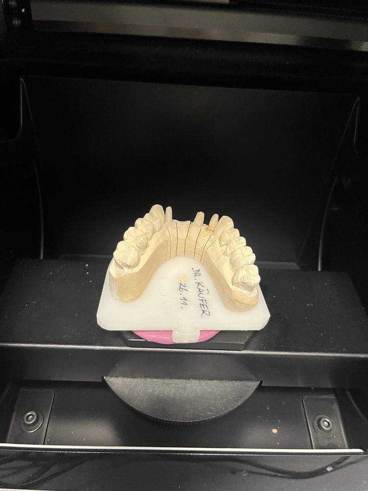 Scaner dentar 3 shape D700 tehnica dentara