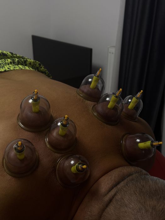 Masaj terapeutic, de relaxare, cupping ventuze