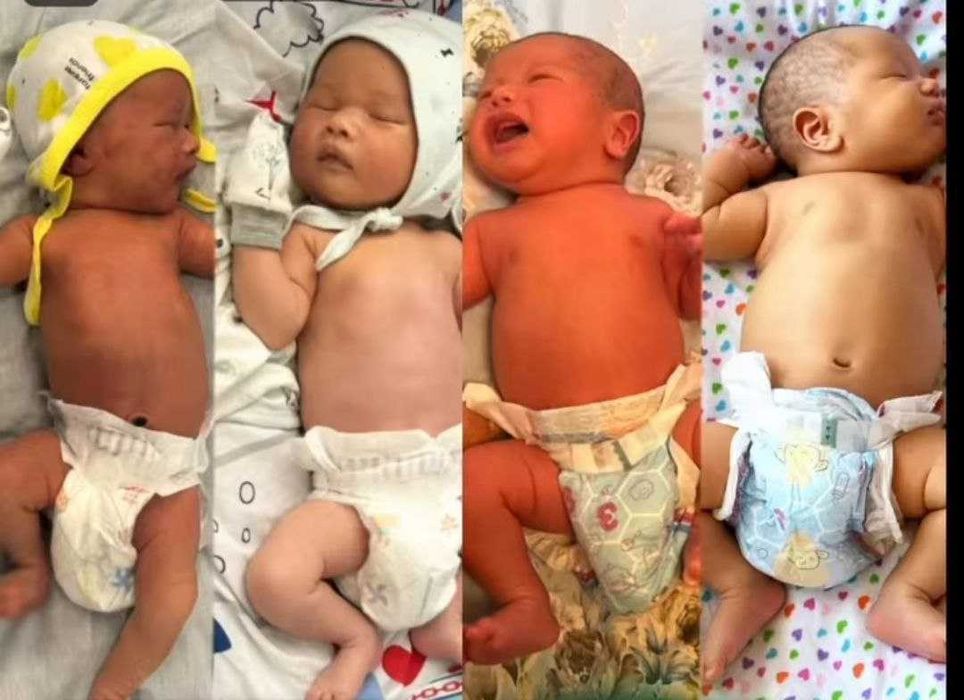 Fotolampa fototerapiya ot jeltuxi v arendu na dom