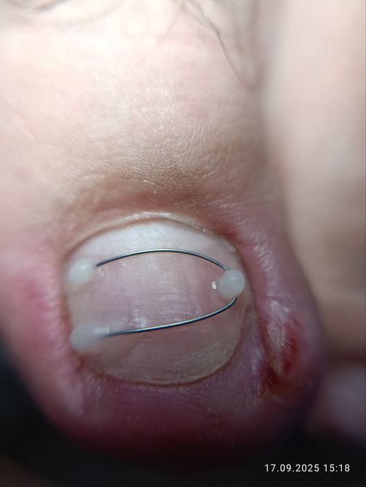 Подолог Сергели.