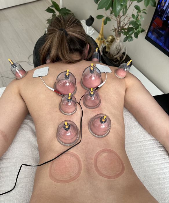 Masaj si recuperare medicala la domiciliul clientului