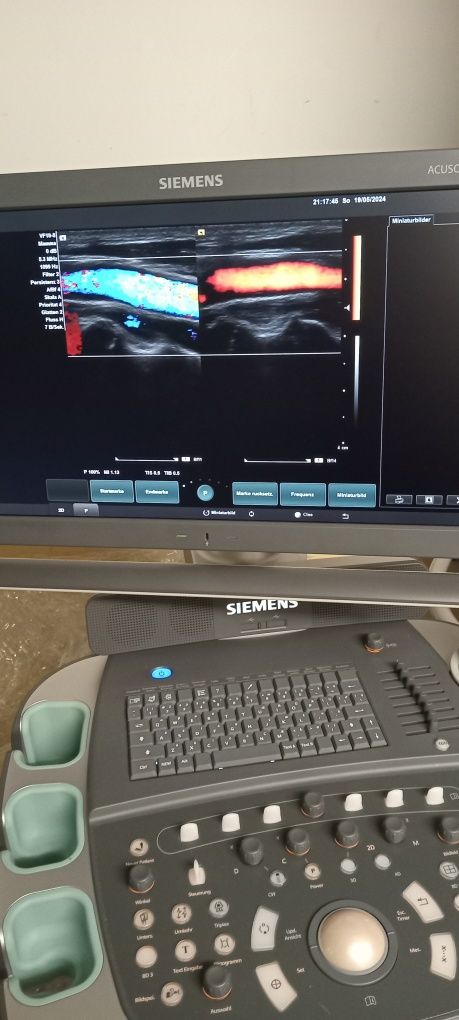 Ecograf Doppler color Siemens
