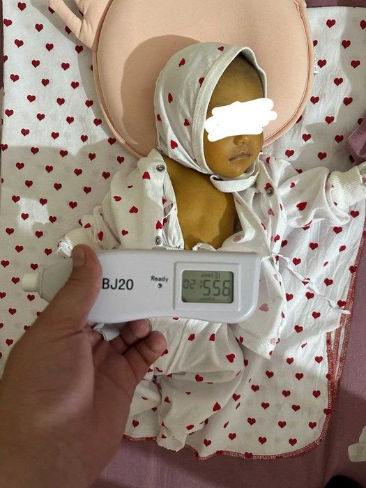 Fotolampa / Fototerapiya / Sariqlik miqdorini aniqlash 50.000