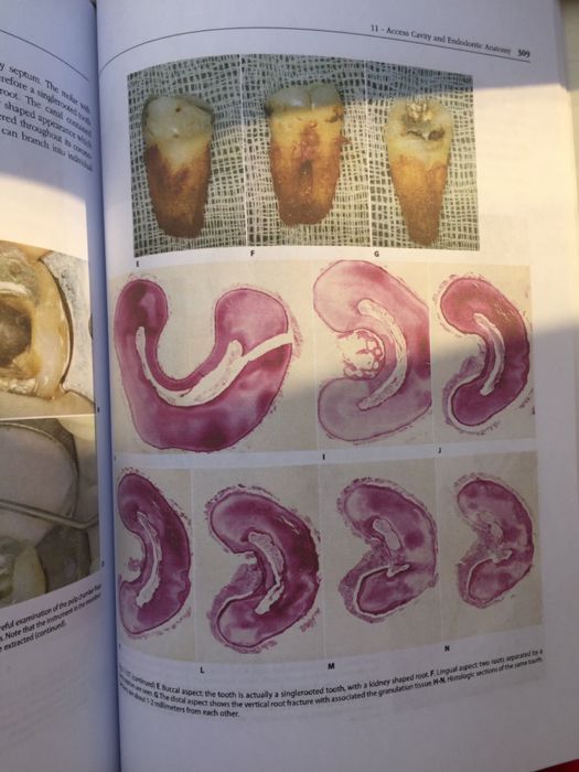 Endodontics CASTELLUCCI vol.1 Editia 2009