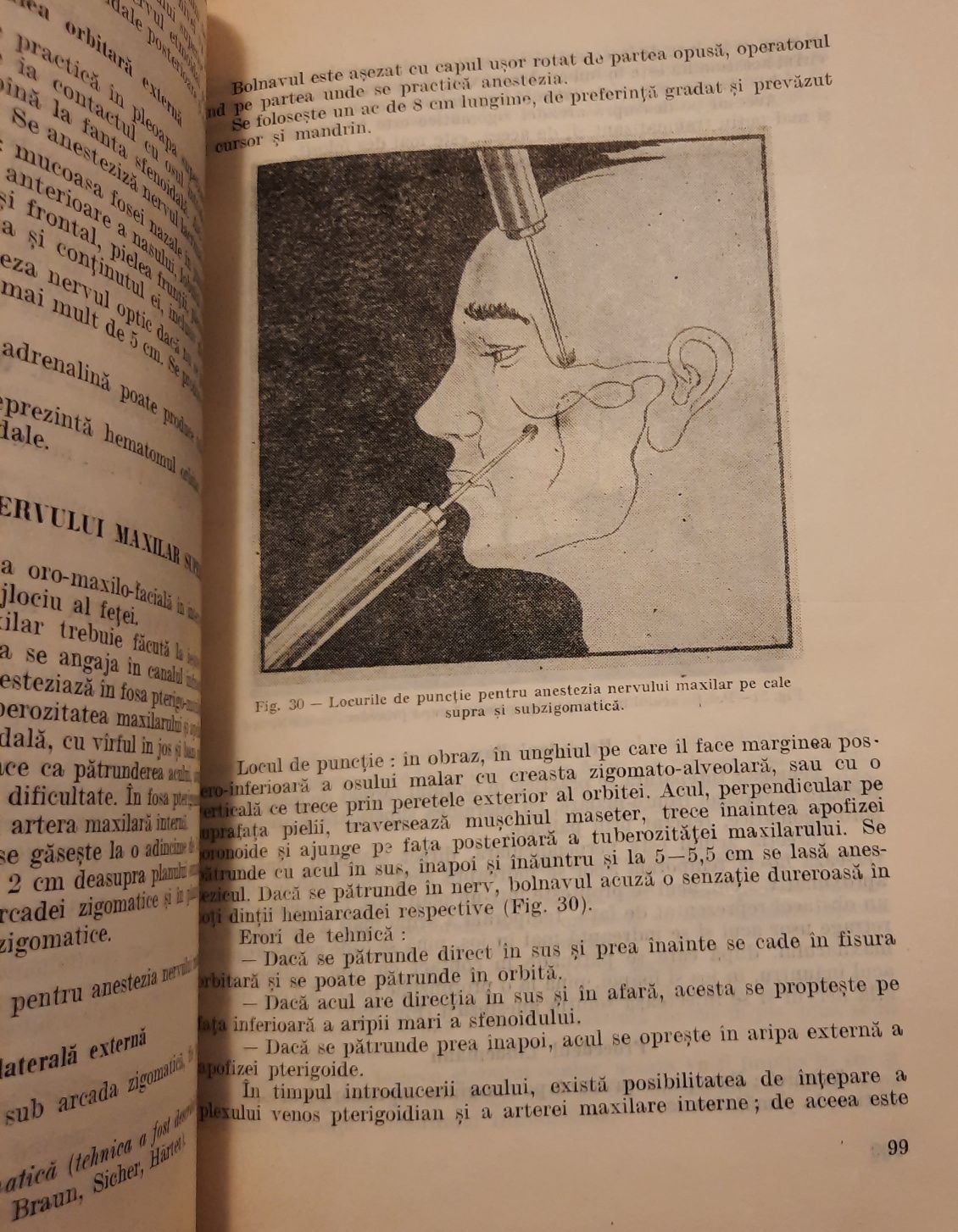 Carte Anestezia in Stomatologie și Chirurgia Maxilo Faciala 1993