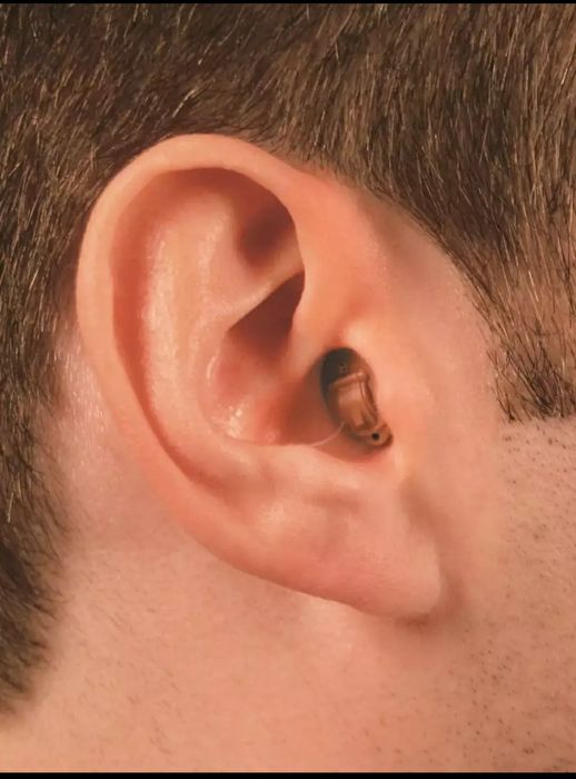 Внутри канальный слуховой аппарат