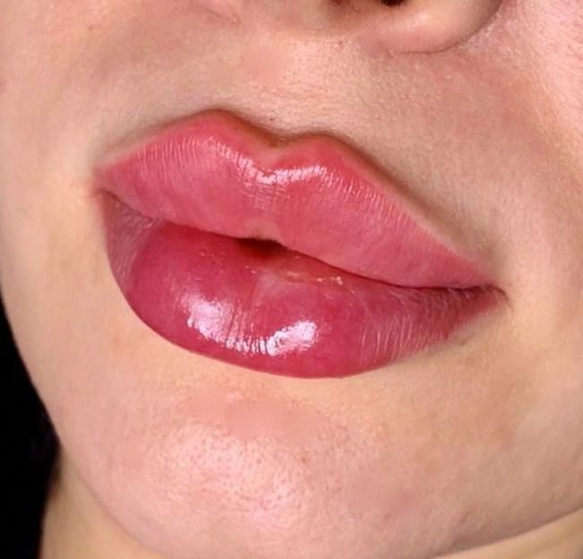 Lab shaklini to'g'rilash va kattalashtirish