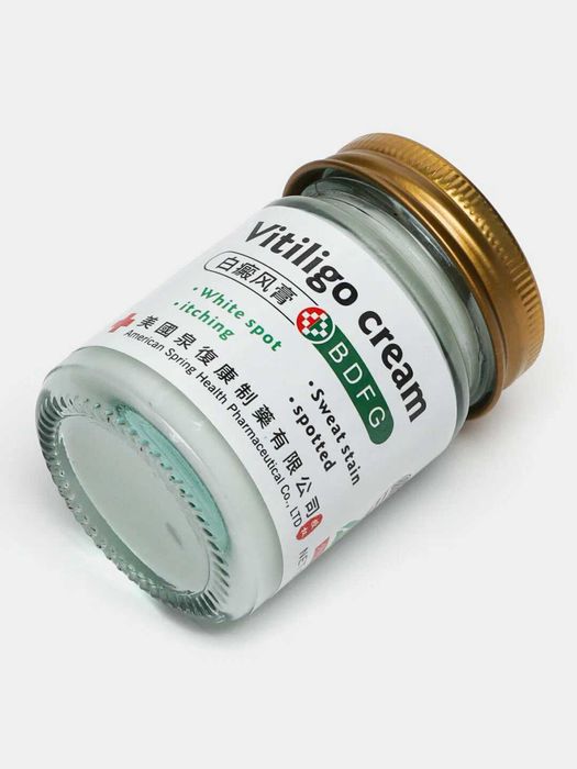 Vitiligo kremi oq doglarga qarshi