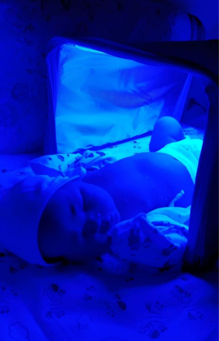 Фотолампа от желтухи, желтушки у новорожденных. Лампа Кювез Аренда.