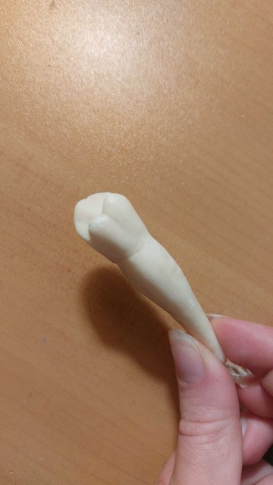 Сапунен зъб 4ти зъб