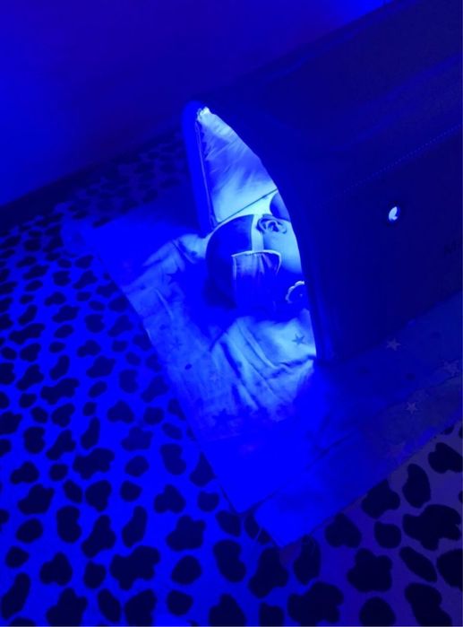 Фотолампа Joylife Maineng для лечения желтухи