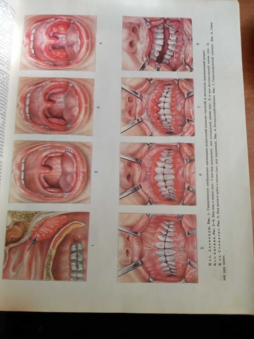 Популярная медицинская энциклопедия, Москва 1984 год 703 стр