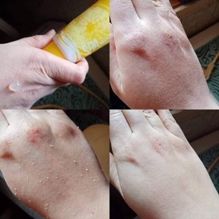 Пилинг лимон