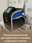 Продам лазер для удаления тату татуажа а также карбоновый пиллинг