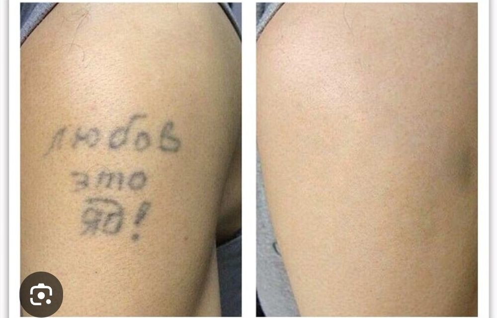 Татуировка учириш