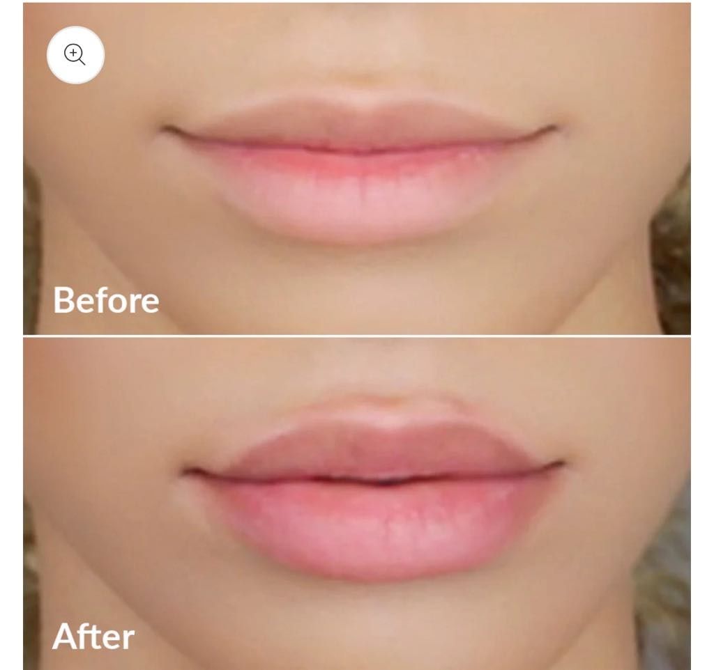 PMD Beauty Kiss Система за увеличаване на обема на устните със серум