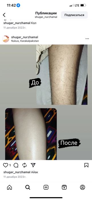 Шугаринг акция да 150.000